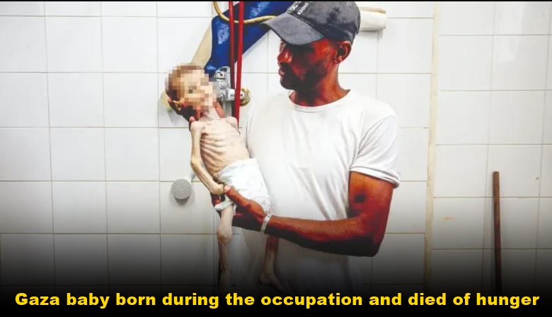 Gaza baby born during the occupation and died of hunger