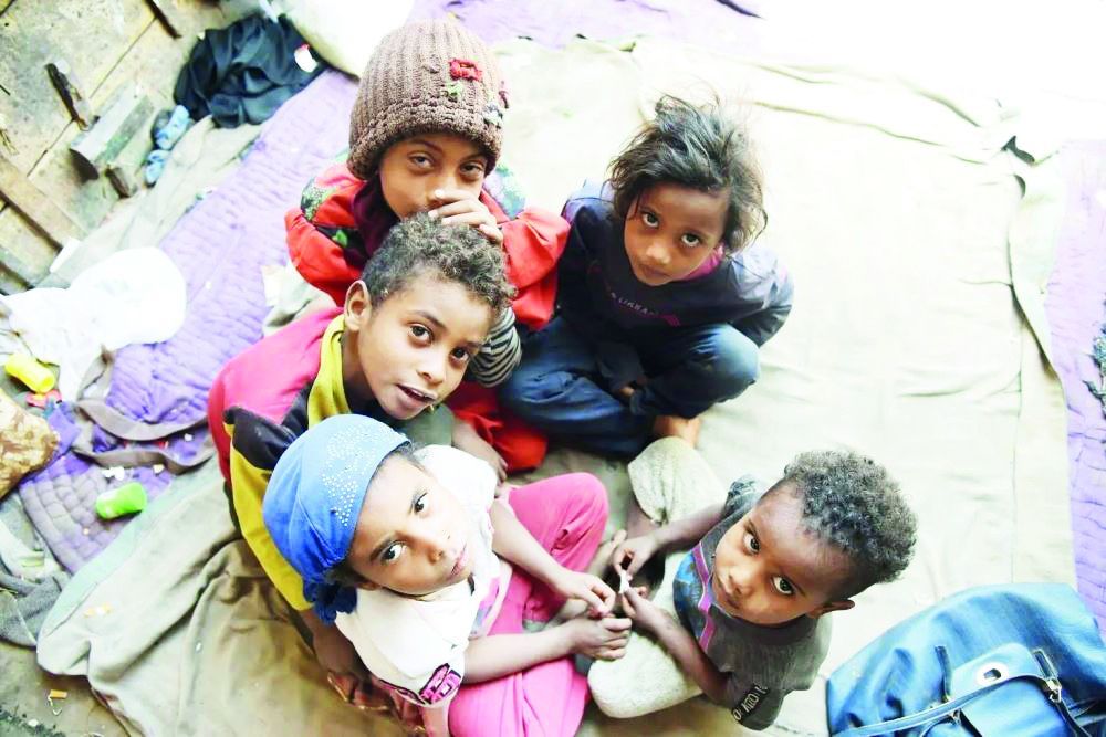 Half a million Yemeni children face acute malnutrition