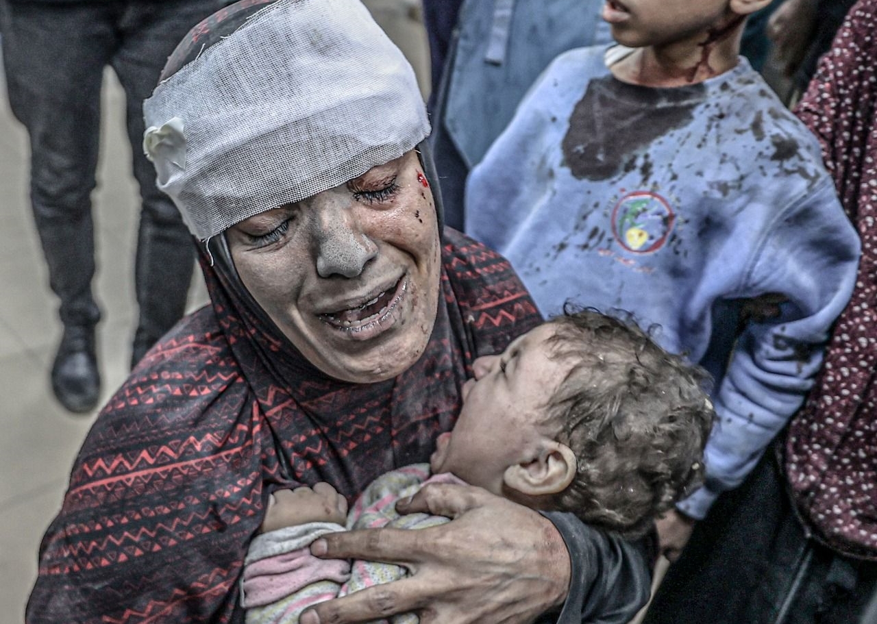 Islamic countries need to take action now! The humanity dying in Gaza